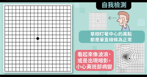 眼睛周圍黃黃的|這張圖你看到的是直線還波浪？新時代視力殺手：黃斑。